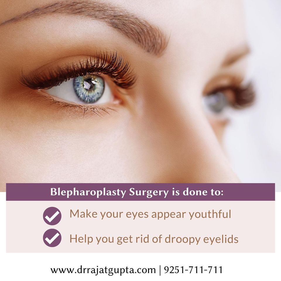 Blepharoplasty or Eyelid Rejuvenation is a procedure that helps to remove and tighten excess eyelid skin for a more alert and youthful appearance....
.
✅Book appointment: bit.ly/RGAappointments
✅ Call: +91-9251-711-711
✅ Visit: drrajatgupta.com
.
.
.
#Blepharoplasty