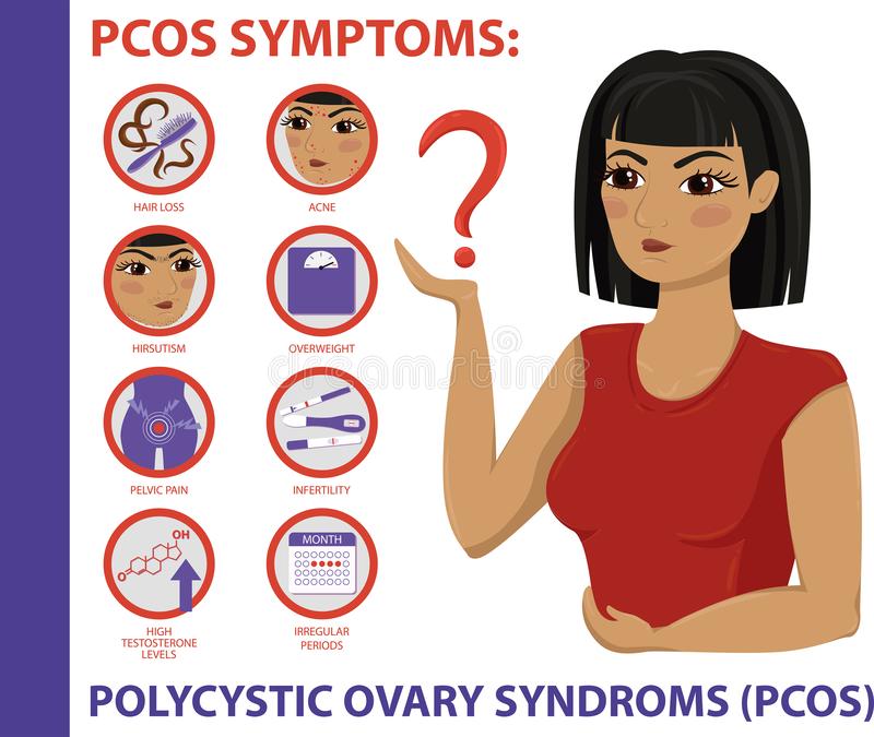 Patient with PCOS may experience; infertilityabsent or reduced mensesrecurrent miscarriageshigh BPtype 2 diabetesoverweighthigher risk of heart disease &hirsutism i.e. excess facial & body hairIn fact, some may show none of these symptoms (asymptomatic)