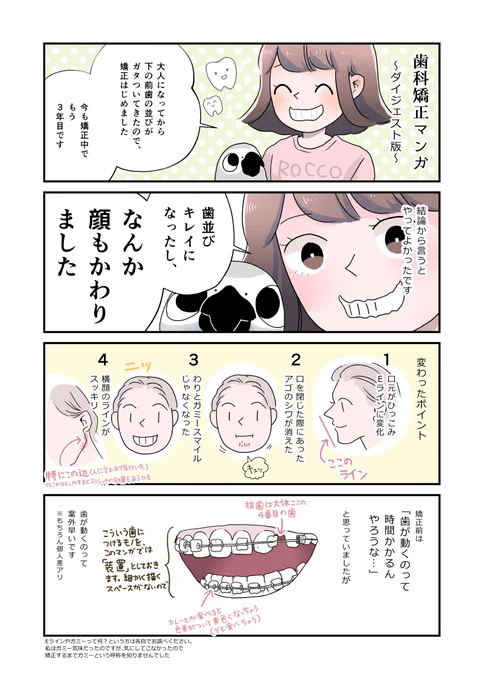 歯の矯正をしているので、ざっくりとレポ漫画を描いてみました。私は抜歯しない方法でもできたのですが、先生と相談してこういう方法でしてもらっています。目立たない矯正とか、裏側からとか、色々あるみたいですね～
#マンガが読めるハッシュタグ 