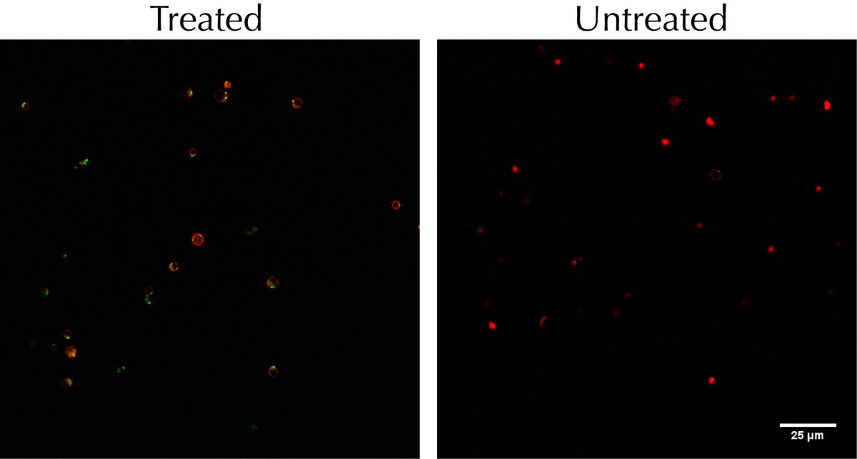 JerryL_NP's tweet photo. (4/5) As an example and proof-of-concept, platelets (outlined in red) were treated with lipid nanoparticles and made to produce a protein that emits green light (left image), compared to platelets that were untreated (right image). https://t.co/xff07Epkyc