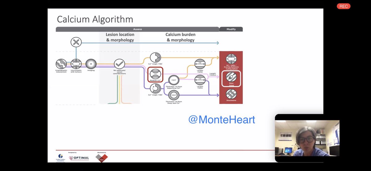 MonteHeart's tweet photo. 2/
Excellent algorithms to save the day! 
▪️When assessing morphology, pay attn. to arc, thickness, length and modularity of CCL. 
▪️Proceed along appropriate arm of algorithm. 
▪️after initial attempt at modification, assess to see if modified at all! Then proceed accordingly.. https://t.co/sa7YPMtmVT