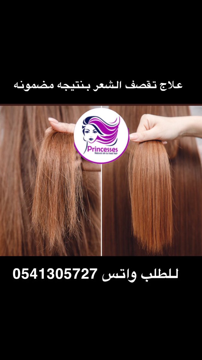 ooooo454671's tweet photo. #علاج#شعرك#بنتايج مضمونه
#كوفيد_19 https://t.co/R0jTLi84CV