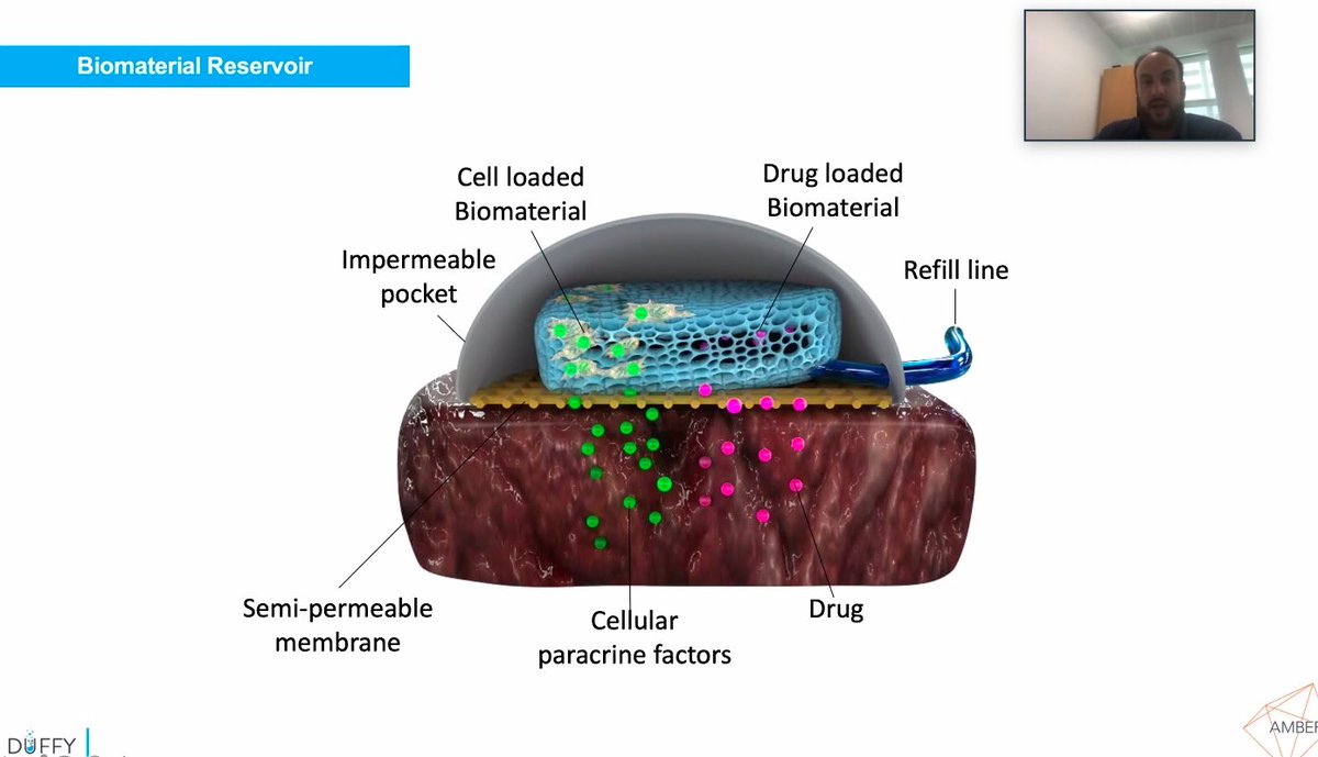 FIRMSymposium's tweet image. Garry has our hearts racing as he kicks off the final #virtualFIRM #webinar series! His research investigates the implementation of medical devices in the heart for retaining stem cells for cardiac repair💓 @gduffy00