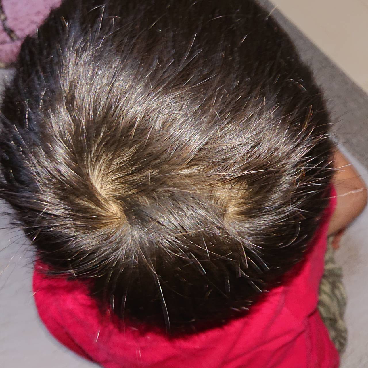 Twitter 上的 柚子 あんず つむじが2つある息子の後頭部 自分では見れないからと撮ってくれと つむじ 2つ T Co D4jyas1whv Twitter