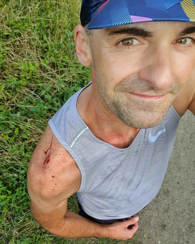 juliendjozikian's tweet photo. Et mince, j'ai rayé le bronzage !
😭😭😭
#instarunners #instarunfrance #running #runstoppable #trailrun #ultratrail #strava #runnersworld #instarun #runneur #runningfrance #trail #partagetontrail # #trailrunning #newbalance #outtrip #happyrunningcrew #i… https://t.co/EAQUC9qBxd https://t.co/eEopkL6Wqr
