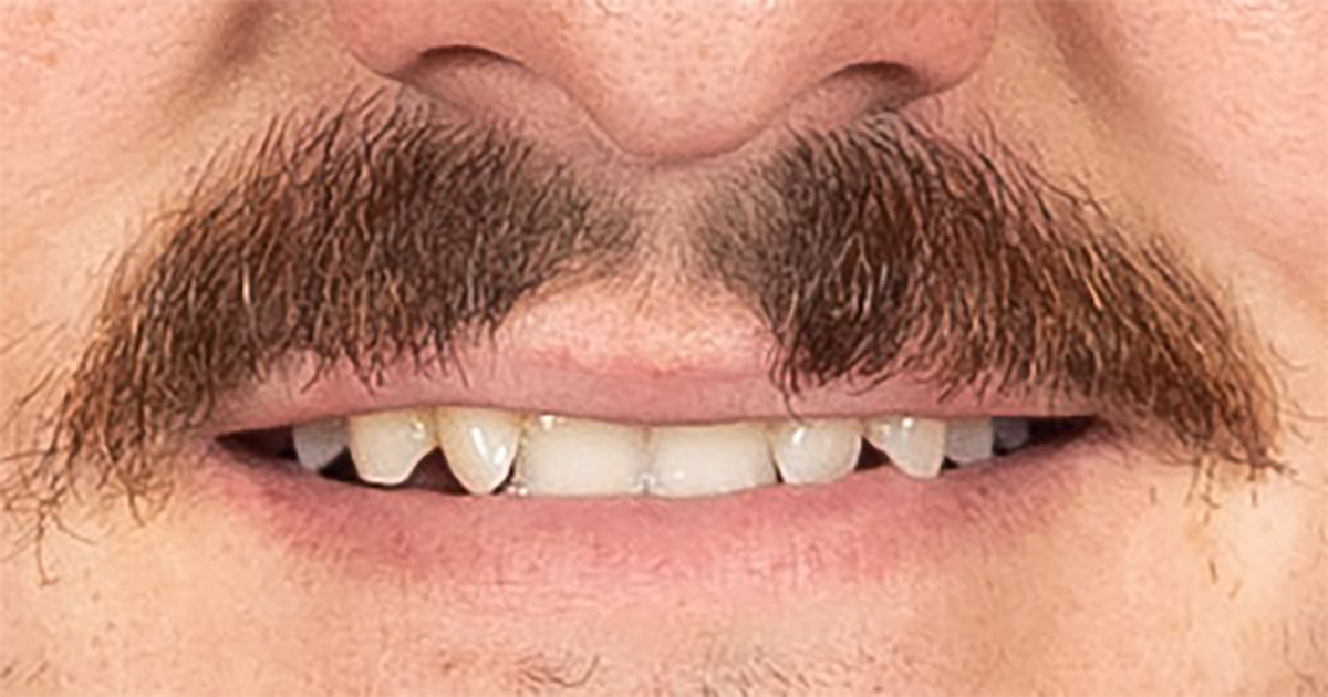 👨🏻 500 retweets and we'll change our profile pic to <a href="/BenManenti/">Ben manenti</a>'s 'stache. 

#smashemsixers