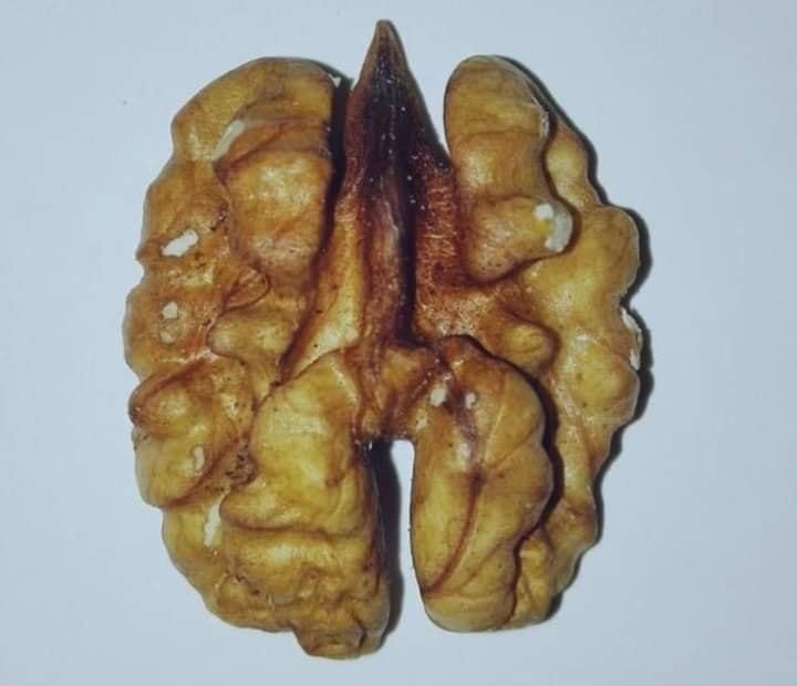 rorromaj's tweet photo. El cerebro de un feto de dos días
¿Todavía piensas en abortar? 💙 https://t.co/9sJlgbpQ7A