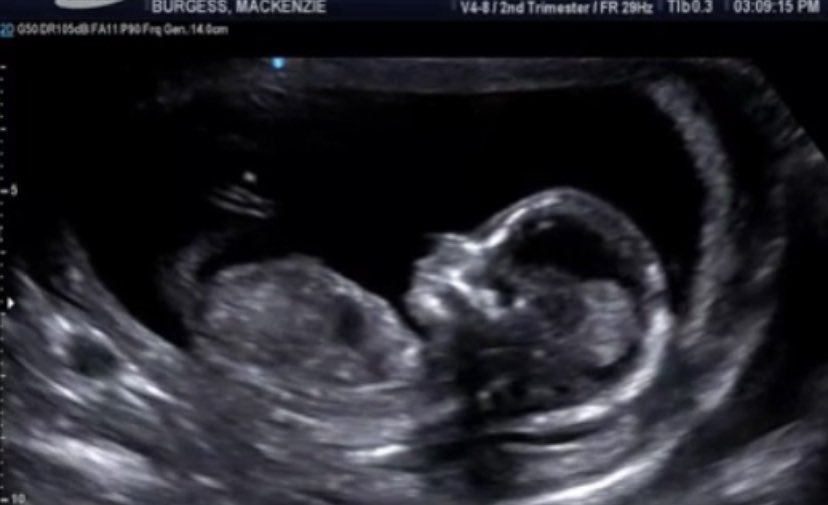 Shared the news with my students today... Baby Burgess coming February 2021! We’re almost halfway there 🥰 
“Why did you wait so long to tell us?!?”
“Why are you not fat yet?”
“You’re not even that moody!” 
🤣😅😆