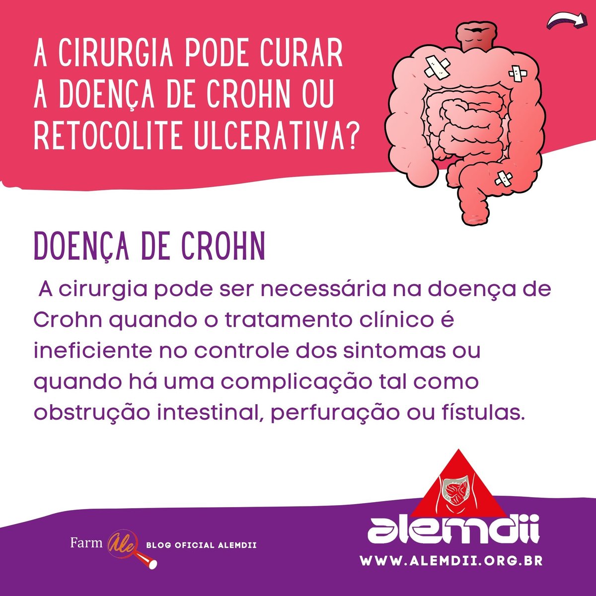 Farmale's tweet image. A Cirurgia Pode Curar a Doença de Crohn ou Retocolite Ulcerativa❓
farmale.com.br/cirurgia-pode-…
 #doençadecrohn #crohn #retocoliteulcerativa #IBD #ALEMDII #farmaleachoudii #coliteulcerativa #ABCD