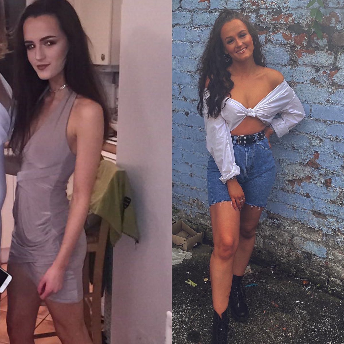 katiemchugh_'s tweet photo. Seeing this picture (left) when going through my old photos has shocked me! I was so pleased with being that skinny but didn’t realise how unhealthy I looked. 4 years later and I’m happier and healthier, not just mentally but physically too, and it shows in these photos. Yay 🥺 https://t.co/IF2Sh109vt