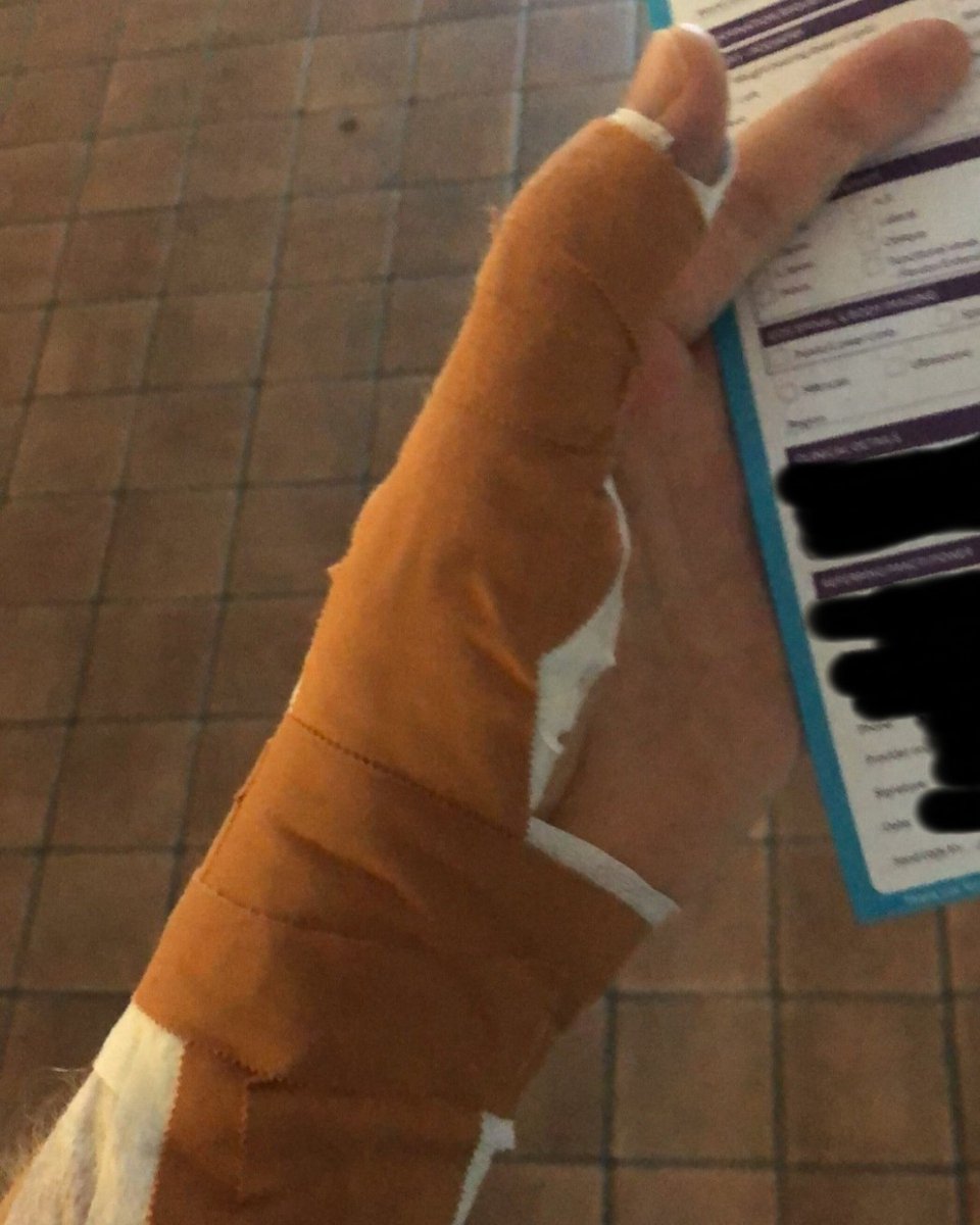 TwoRedKites's tweet photo. Who said #softwaredevelopment isn't a #dangerous game? 🙃
Luckily, both fearless #2RK #leaders, Nigel (head) and Geoff (thumb), are back to their #productive selves and feeling much better after unrelated trips to the doctor. Stay #safe this week, everyone! ♦️♦️ https://t.co/GVgc2RmG6P