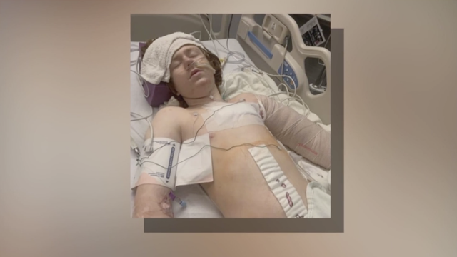 thehill's tweet photo. 13-year-old boy with autism shot by police after mother called for help https://t.co/d4vOFAlUlU https://t.co/Dr92OcJtbe