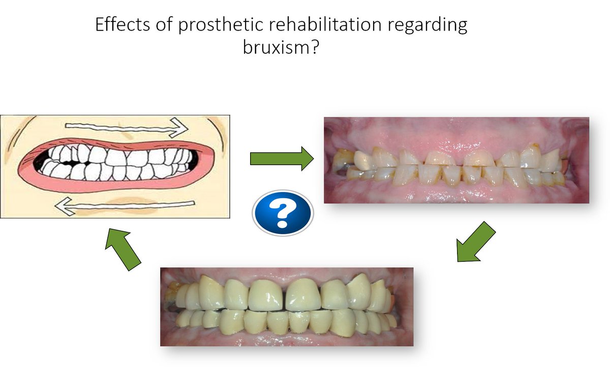 What is the treatmenteffect of #prosthodontics for bruxers with extensive #toothwear. That is my science Project. #PhD #scicommUU20
