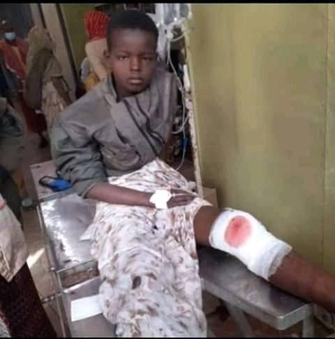 Derart14's tweet photo. This young boy's name is Bahar Ahmad , he was shot by Ethiopian military forces at Awoday town. @UNHumanRights @UN @amnesty @hrw @AmnestyEARO @PPHRtweets #Oromo #Ethiopia #OromoProtests @LarryDiamond @SecPompeo @amyklobuchar @TinaSmithMN https://t.co/sHD0uEHAJP