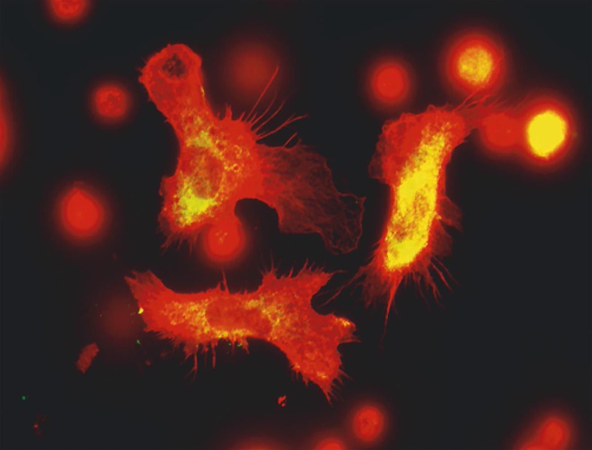 StemCellAmerica's tweet photo. We use Fetal Hematopoietic Stem Cells- the precursor cells to those found in our bone marrow- in our treatments. These cells have the ability to rebuild the immune system. 🧬️Here's how science is reflecting on this. https://t.co/xTJ8Rg1Ldv…/ #immunity #stemcellresearch https://t.co/Ii01SZMND1