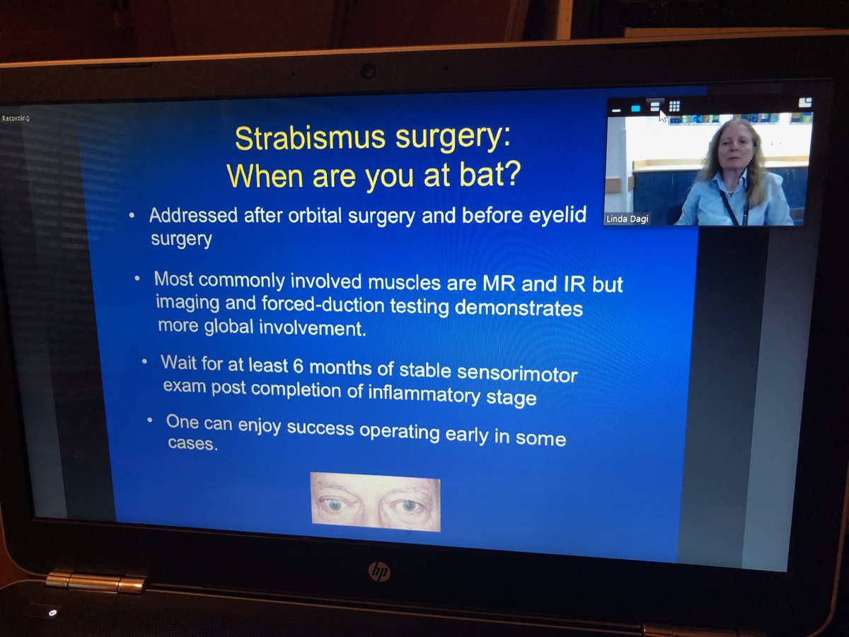 Thank you Dr. Linda Dagi of <a href="/bostonchildrens/">Boston Children's</a> for kicking off this week’s morning rounds with a discussion on Graves’ Orbitopathy from a Strabismus Surgeon’s Perspective. The full recording can be found on <a href="/EyeRounds/">EyeRounds</a>: bit.ly/335fWYm