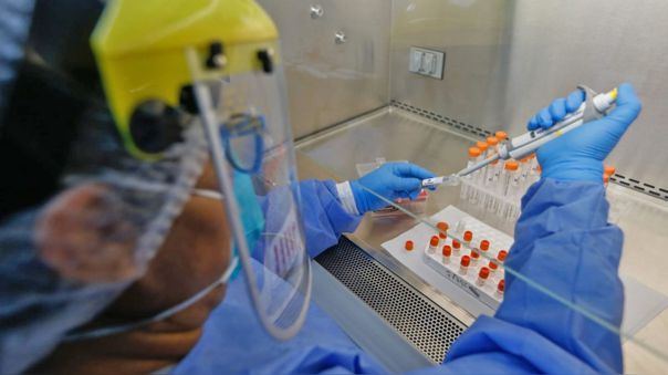 DePerublog's tweet photo. El Perú ya usa su propia prueba molecular
https://t.co/hXBWKPNpCA https://t.co/Av6dPZQ1F1