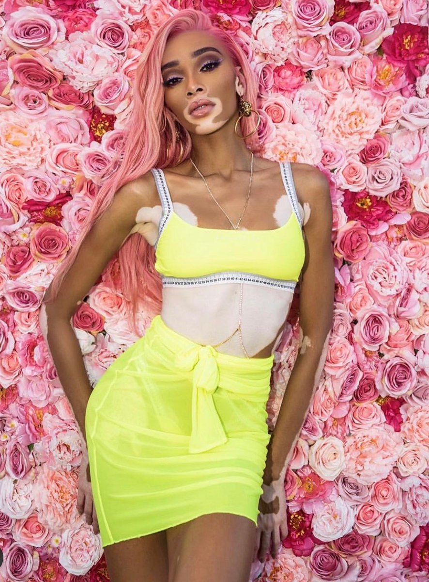misurare's tweet photo. @winnieharlow https://t.co/20mUTiboWl