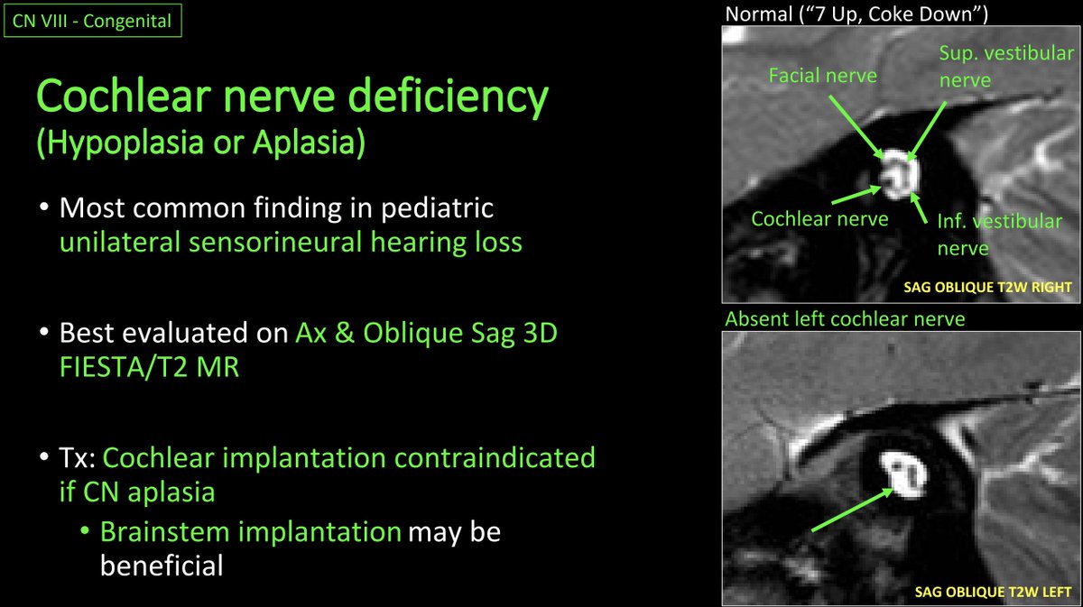 WmOBrienDO's tweet photo. #ASHNR20: #GreatEE (EE204) from Jennifer Huang, et al. titled 'A Little Nervous: A Review of Pediatric Cranial Nerve Anatomy &amp; Disorders.' Beautiful illustrations incl congenital, acquired &amp; neoplastic pathology affecting CNs. Some ex educational cases below:
@ASHNRSociety
#HNRad https://t.co/GRIwYbCMuv