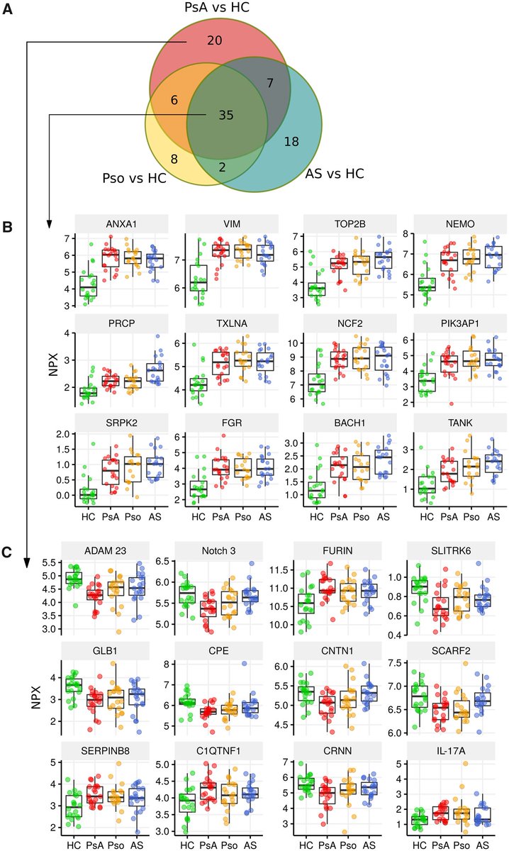 Now published online <a href="/RheumJnl/">Rheumatology & Rheumatology Advances in Practice</a> our latest research on proteomics in psoriasis and psoriatic arthritis, revealing a shared serum proteomic signature (academic.oup.com/rheumatology/a…). #psoriaticskin #psoriaticarthritis #psoriasis