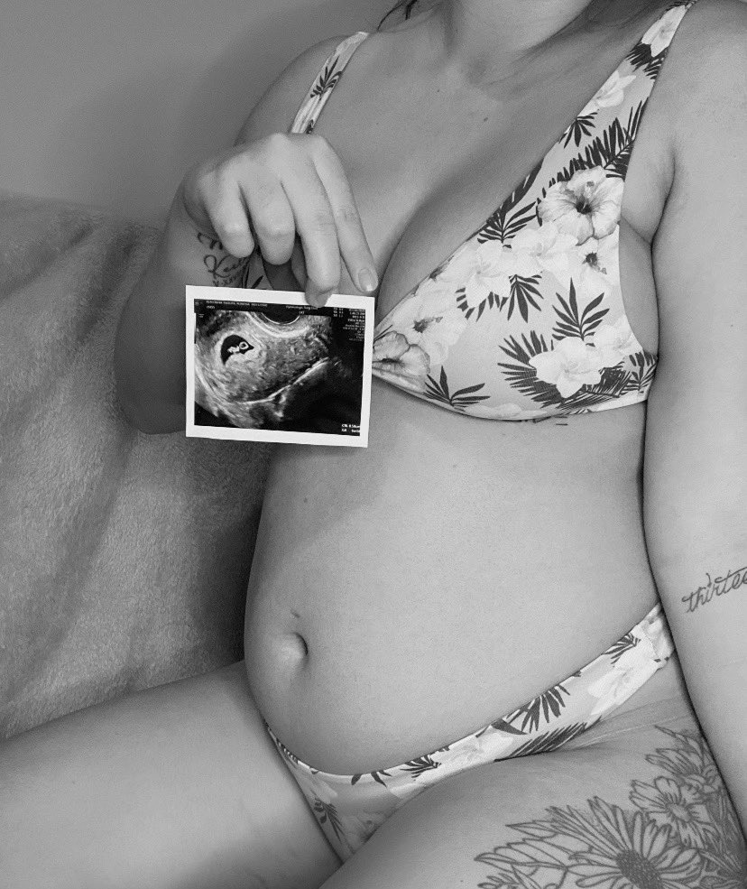 fuckrenabebs's tweet photo. Hahahaha oops! Longest secret I’ve probably ever kept lmao can’t wait to meet my witto baby 🤍 https://t.co/k20NXppIIV