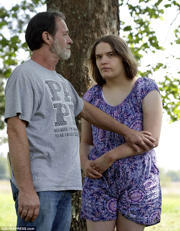 She was so destructive that the strain caused the couple to divorce.She lives in a group home now, unable to speak or communicate.Her father visits several times a year.