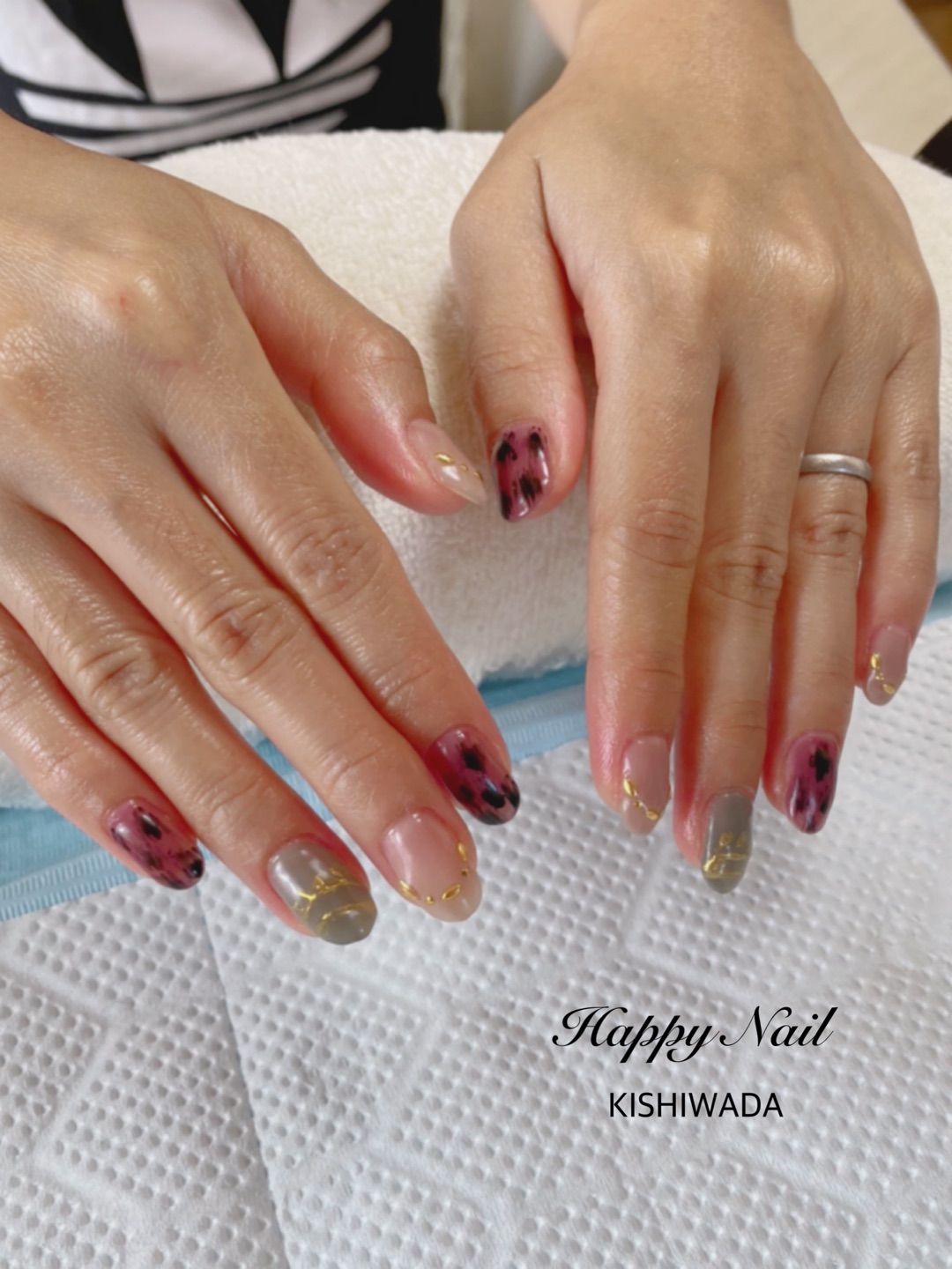 岸和田 Happy Nail 深爪矯正のお客様の卒業後 ー アメブロを更新しました 深爪矯正 T Co Lpqowzyft2