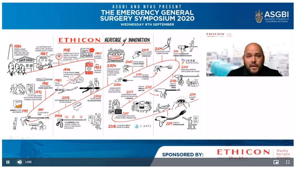 asgbi's tweet photo. Welcome to Ben Hart from @Ethicon for talking to us today about the evolution of surgical stapling.  This slide is a great visual of the innovation journey.  Thanks to Ben and all of the team @JNJMedDeviceUKI #ASGBIEGS https://t.co/K4HHWIycmW