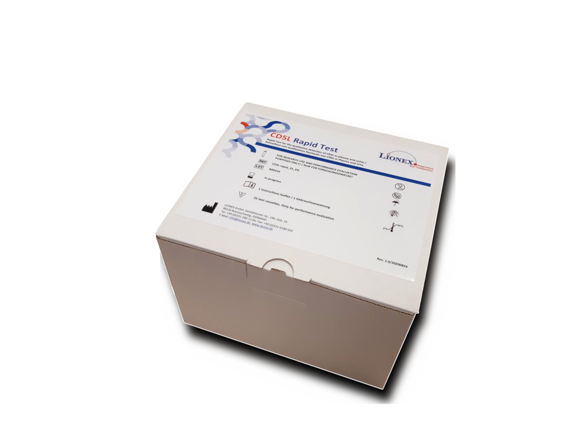 Innate_IGTP's tweet photo. Good news from our partners at #Lionex Diagnostics & Therapeutics! 1800 CD5L rapid tests that we co-developed @GTRecerca are being shipped to Wits Health Consortium @Wits_News in SouthAfrica. Looking forward their testing at the #SMATB Clinical Trial, funded by @EU_H2020. https://t.co/Hk5Heij9AD