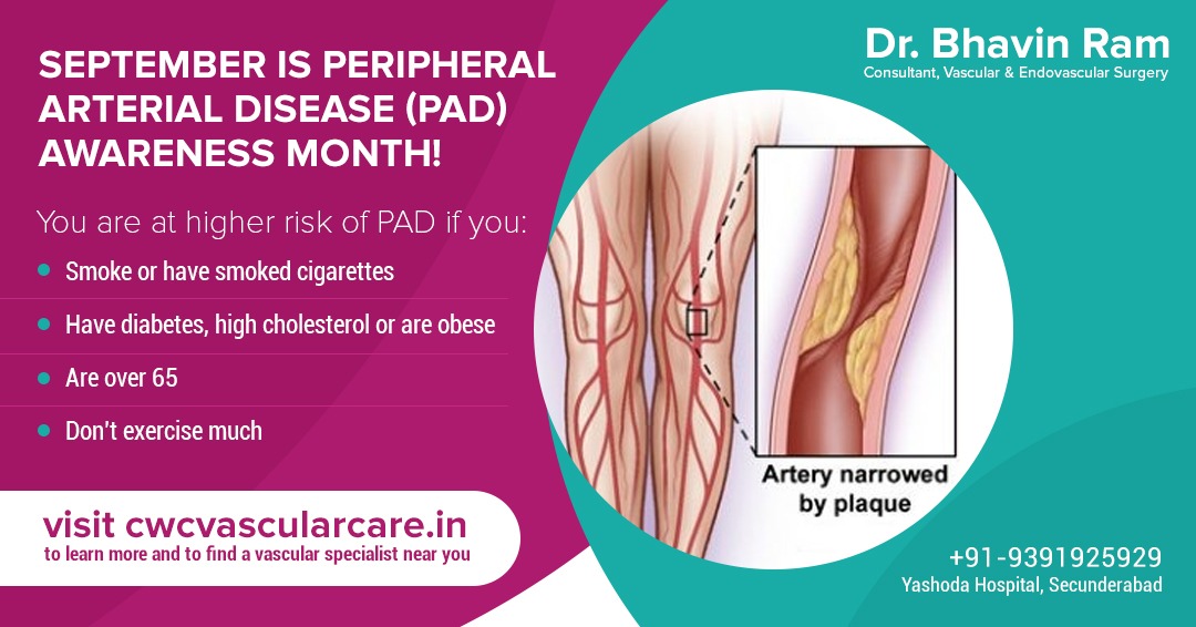PAD is a serious, vascular condition that often goes undiagnosed and could lead to amputation if left untreated. This September, helps us to spread awareness about this disease.Visit us to learn more and find a vascular specialist near you.
#PADawareness #padawarenessmonth