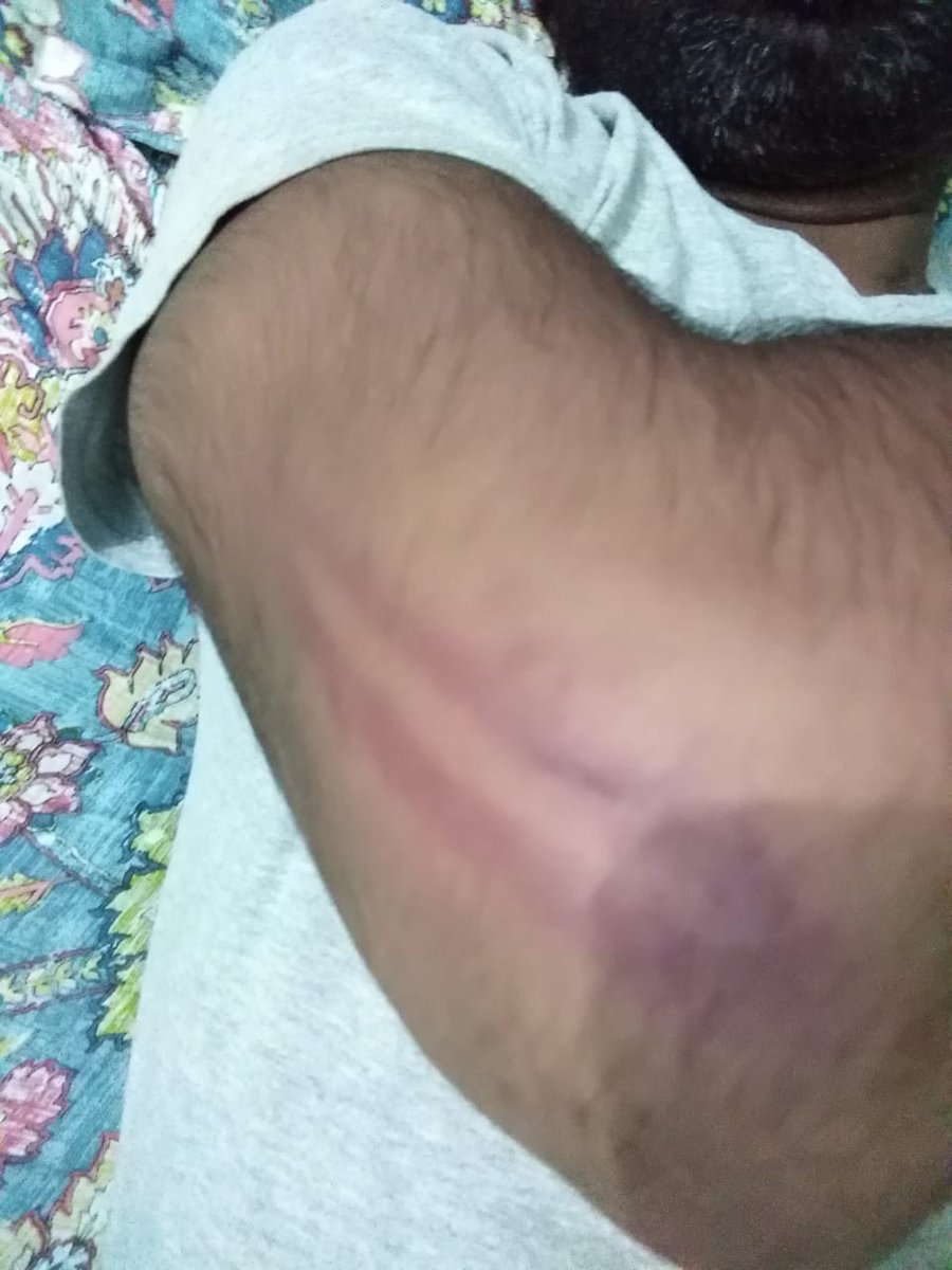 MHanif48's tweet photo. #IbrahimGroup
کےساتھ مل کر پولیس تھانہ بلاچنی نے رات 1بجے پرامن دھرنے پر لاٹھی چارج کر دیا مزدور سب زخمی ہو گے کچھ کو پکڑ کے حوالات میں ڈال دیا 
@DIGOpsLahore @OfficialDPRPP 
اس بات کا نوٹس لیں تا کہ پولیس غنڈہ گردی ختم ہو سکے
@siasatpk @PakPMO @ImranRiazKhan @ARYNEWSOFFICIAL https://t.co/HDzjRi6n6E