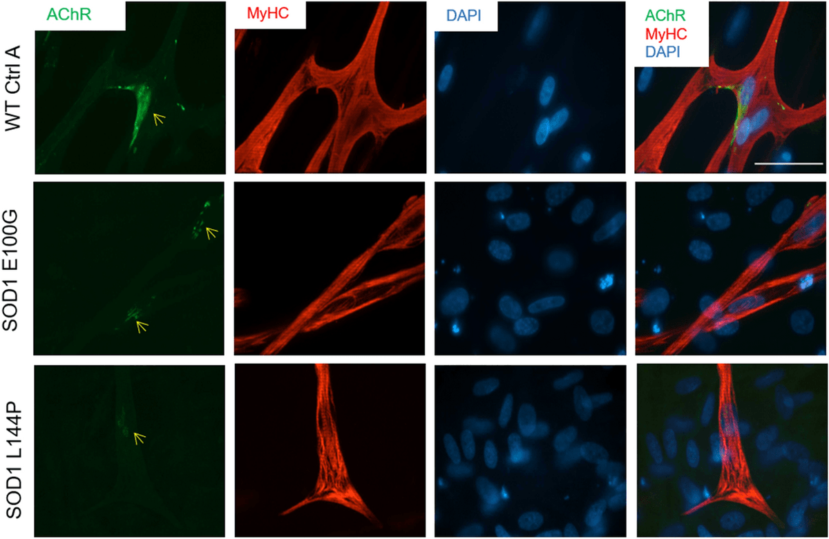 HesperosInc's tweet photo. We’re excited about our latest publication in Nature Scientific Reports, that demonstrates use of a functional, skeletal muscle model to help researchers better understand (and treat) ALS. 
https://t.co/284eholG3Y 
#ALS #UCF #OrganOnaChip #HoaC #HumanOnAChip https://t.co/L1AfWqKAKs
