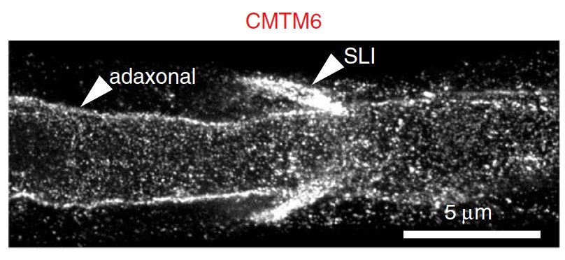 4/10 By STED microscopy with  @ElisaDEste and using cryo-immuno electron microscopy we found that CMTM6 is indeed localized at the SC membrane facing the axon. But what does CMTM6 do at this contact zone?