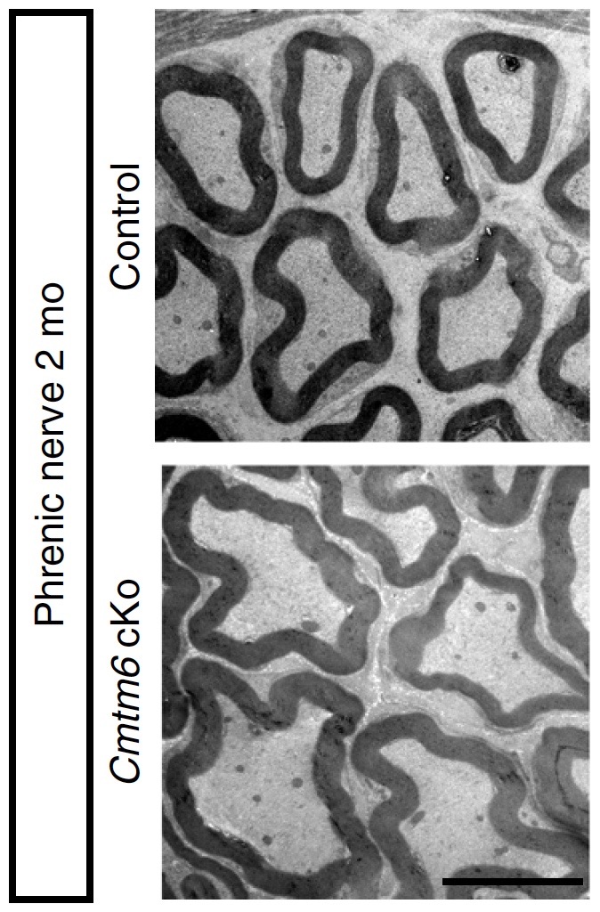 5/10 At the department of  #Neurogenetics  @maxplanckpress, we deleted the gene encoding CMTM6 in SCs of mice. Much to our surprise we found in various peripheral nerve types considerably larger diameters of axons, both myelinated and non-myelinated.