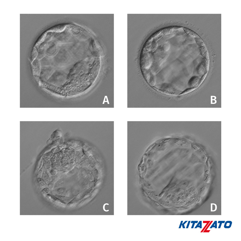 KitazatoIVF's tweet photo. It's #quiz time!
In a freeze-all program, which order of these day 5 blastocysts would you choose for future FET (from best to worst)?
#kitazato #kitazatoivf #vitrification #embryology #ivfhero #blastocyst https://t.co/FxGMUzm4XI
