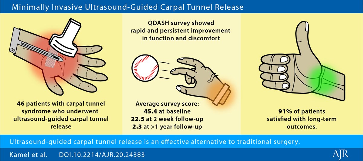 Ultrasound-guided carpal tunnel release may be a safe, effective, and less invasive alternative to traditional surgery. ajronline.org/doi/abs/10.221…