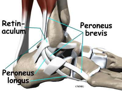What is it?Peroneal tendon dislocation with ankle dislocation/subluxation. Could also be a torn peroneal tendon as this is commonly associated with a dislocation. Healthy Anatomy