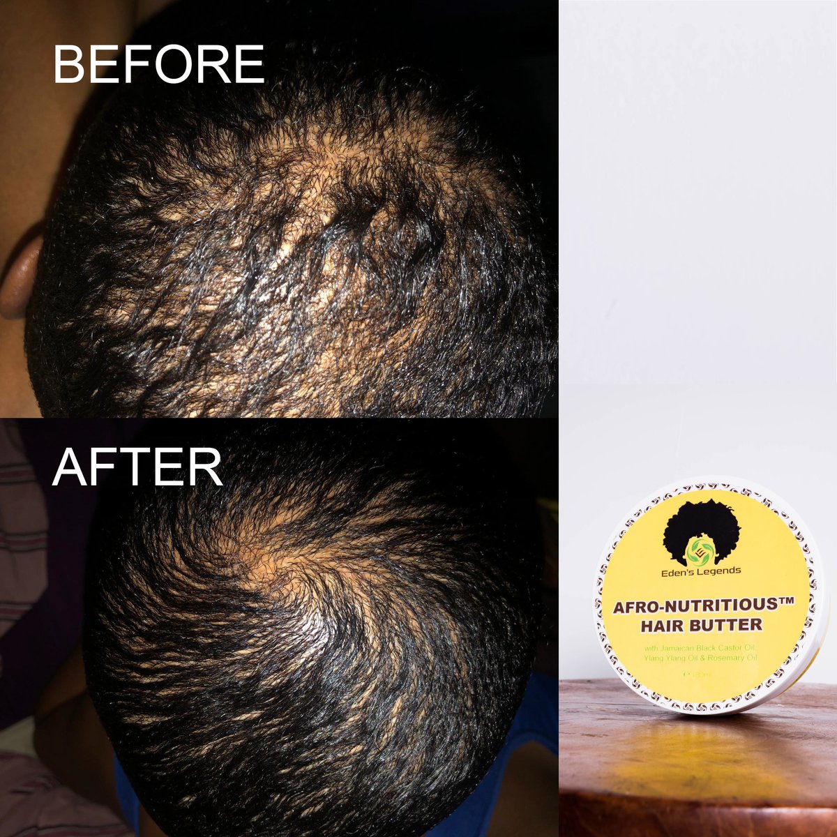 EdensLegends's tweet photo. Another Great Result. We love when our customers are keeping us up-to-date about their progress with our product. Afro-Nutritious Hair Butter
*Customer Review* #damagedhair #recedinghair #thickhair #baldhair #organic #handmade #moisturising #vegan #africa #bestseller #hairsalon https://t.co/1JKIig2gP3