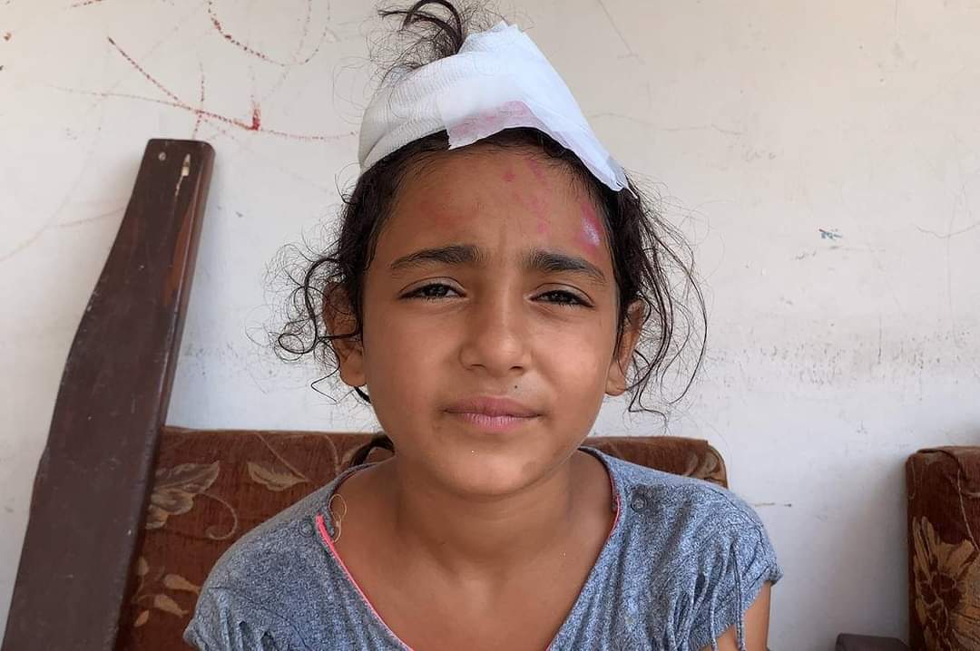 UNICEFLebanon's tweet photo. “I was showering and, when the impact hit, the first aid box exploded on my head. I remember that I just started screaming. My mother ran to me, pressed hard on my wound, so I wouldn’t faint.” Mira,10, was at home when the #BeirutBlast hit her house. More: https://t.co/P4jRBREkro https://t.co/DD3Othu6LD