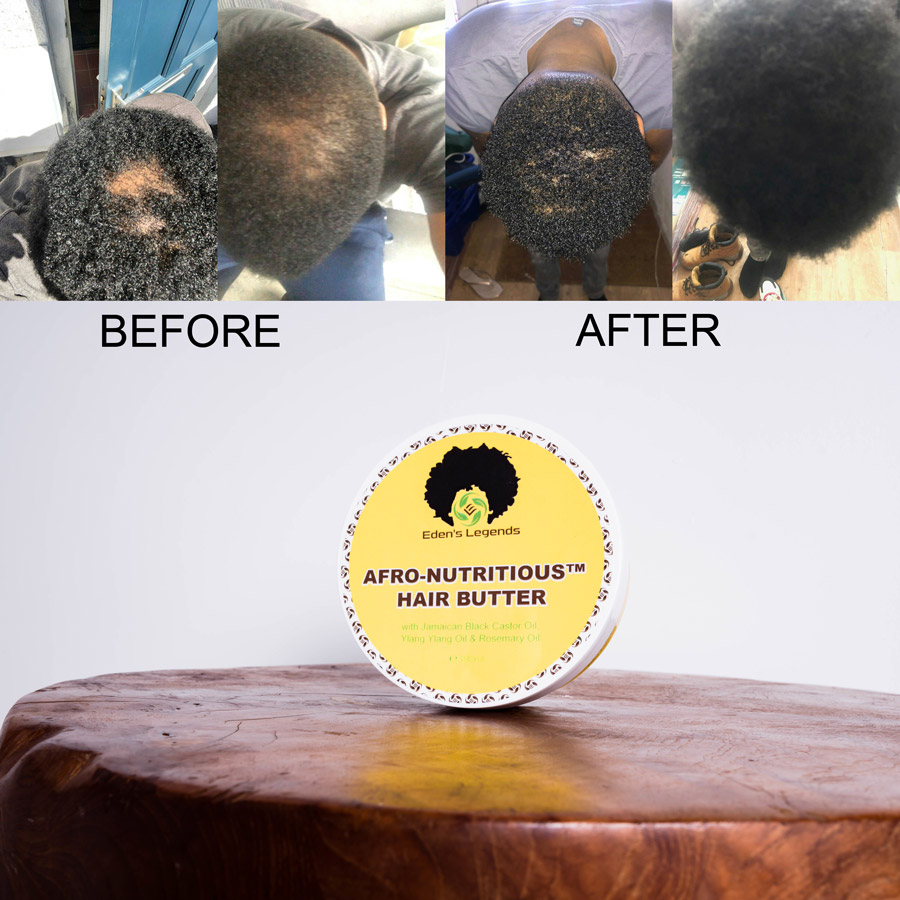 EdensLegends's tweet photo. We are always happy😀when our customers share the results they're getting from our products.
Afro-Nutritious Hair Butter *Customer Review*
#hairrepair #damagedhair #recedinghair #thickhair #baldhair #organic #handmade #moisturising #vegan #UK #bestseller #hairsalon #barbers https://t.co/gZYY17gSAY