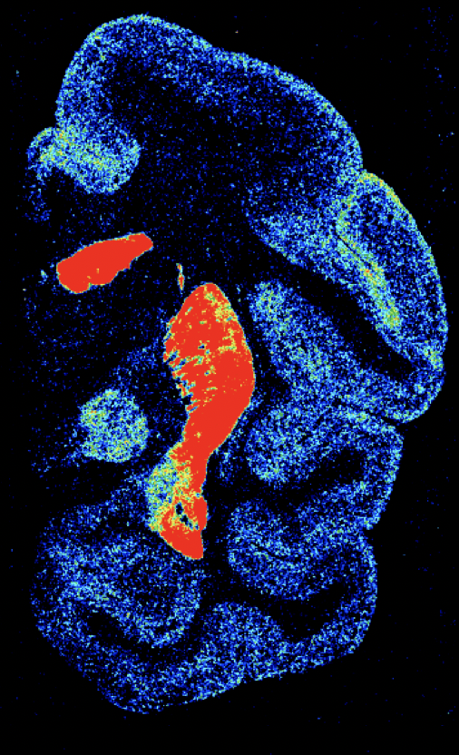 3) The amazing Palomero  @NiuMeiqi Lucija Rapan & Zilles painstakingly measured dopamine D1 receptors across 109 (!) areas of cortex. It turns out that sensory and motor areas have relatively few D1 receptors, but frontal and parietal areas involved in higher cognition have lots!