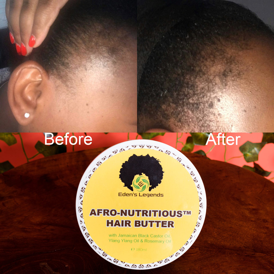 EdensLegends's tweet photo. Another great result from our customers-
Afro-Nutritious Hair Butter *Customer Review*
#hairrepair #damagedhair #recedinghair #thickhair #baldhair #organic #handmade #moisturising #vegan #UK #bestseller #hairsalon #barbers #bestseller #hairsalon #barbers https://t.co/1MdgTtdKJD https://t.co/w88rMjMYnT