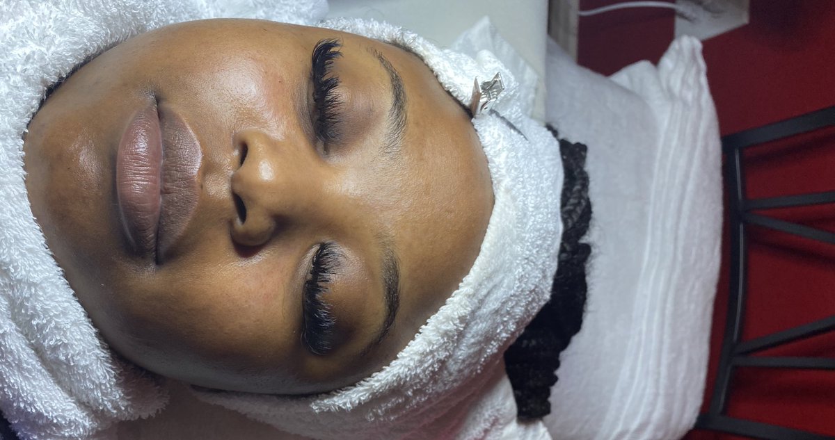 Noir99__'s tweet photo. Before &amp; After Dermaplaning facia🧖🏾‍♀️ https://t.co/Pv2EFzBXnR