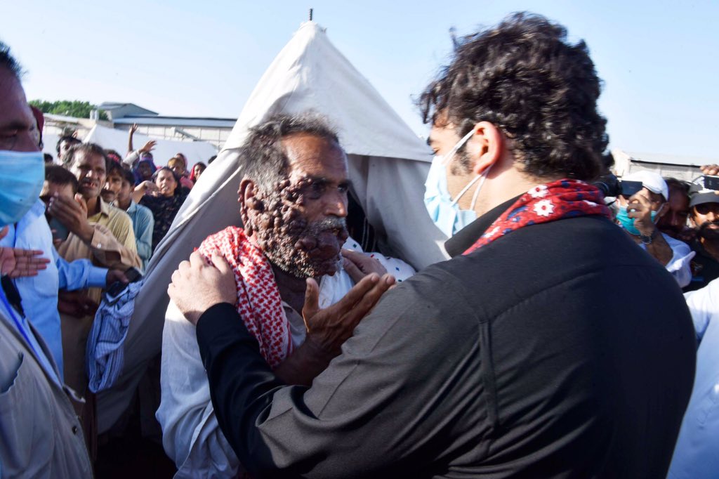 SANGHAR, September 9: Chairman PPP <a href="/BBhuttoZardari/">Bilawal Bhutto Zardari</a> during his visit to a relief camp for rain-affected people in Khipro is talking to a poor labourer, Jumoon Kunbhar, who is suffering from unidentified skin disease and is unable to get treatment due to poverty.