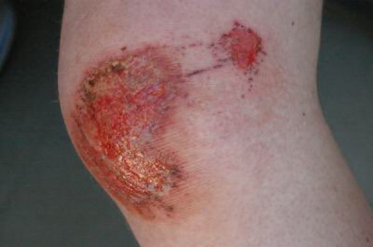LeBronCenaOrton's tweet photo. I miss when the only pain in my life was this https://t.co/GHLwdIAr9v