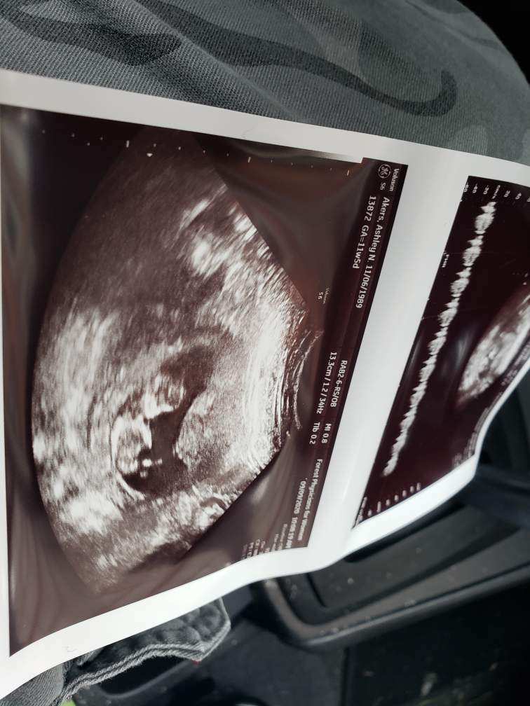 Here we go with new baby pictures. <a href="/Keifexxx/">keife</a> @cmperez30 <a href="/maliciousmiss13/">SpeechyKeen13 🥹</a> <a href="/Darthmgoat/">🐐 DARTHMGOAT 🐐</a> <a href="/crissy306/">Crissy3❄️6</a> <a href="/VGamingPlays/">VGamingPlays</a> <a href="/DanieWasHereToo/">DanieWasHere</a>