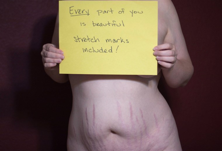 ModsOfDiversity's tweet photo. "Hating your body won't make you thin. and being thin won't make you stop hating your body. love yourself first. " https://t.co/SzjebAWMHf