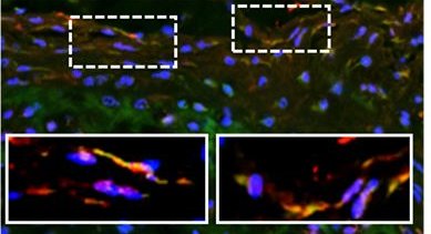 Wuertz Lab (@wuertz_lab) on Twitter photo Check out our latest paper one #bone and #stress in <a href="/IJMS_MDPI/">IJMS MDPI</a> with <a href="/IsabelleMMansuy/">Isabelle M Mansuy</a> <a href="/eth_bone/">Ralph Müller</a> <a href="/Elena_Cambria/">Elena Cambria</a> <a href="/martroki/">Martin Roszkowski</a> and more collaborators at <a href="/unipotsdam/">Universität Potsdam</a> <a href="/jlugiessen/">Universität Gießen</a> <a href="/LMU_Muenchen/">Universität München</a> <a href="/ETH_en/">ETH Zurich</a> @paracelsus_uni and of course <a href="/_RITEngineering/">Kate Gleason College of Engineering</a>: mdpi.com/1422-0067/21/1… Check out our latest paper one #bone and #stress in <a href="/IJMS_MDPI/">IJMS MDPI</a> with <a href="/IsabelleMMansuy/">Isabelle M Mansuy</a> <a href="/eth_bone/">Ralph Müller</a> <a href="/Elena_Cambria/">Elena Cambria</a> <a href="/martroki/">Martin Roszkowski</a> and more collaborators at <a href="/unipotsdam/">Universität Potsdam</a> <a href="/jlugiessen/">Universität Gießen</a> <a href="/LMU_Muenchen/">Universität München</a> <a href="/ETH_en/">ETH Zurich</a> @paracelsus_uni and of course <a href="/_RITEngineering/">Kate Gleason College of Engineering</a>: mdpi.com/1422-0067/21/1…