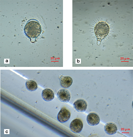 mixotrophs's tweet photo. New study by @MairaMaselli on the #Ecophysiological traits of the #mixotrophic #ciliate Strombidium spp
#plankton #mixotrophy
@MSCActions @EU_H2020 @JPlanktonRes @PerJuelHansen1
https://t.co/29xrBaOzHD https://t.co/QdOBvuixbx