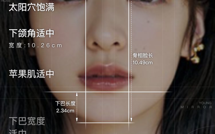 失敗しない整形名医選び フェイスリフト 目の下のたるみ クマ 脂肪注入 切開リフト 糸リフトの修正 スプリングスレッド 溶けない糸 Vovリフト 溶ける糸 テスリフト 溶ける糸 などが最近人気の施術です たるみの目安としては 中程度